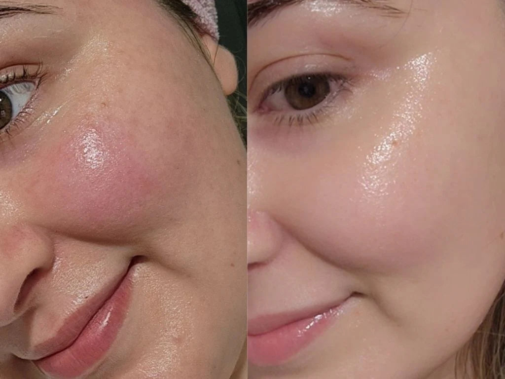 Glycolic Acid 7% Toner (150ml)