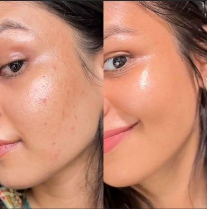 Glycolic Acid 7% Toning Solution (150ml)