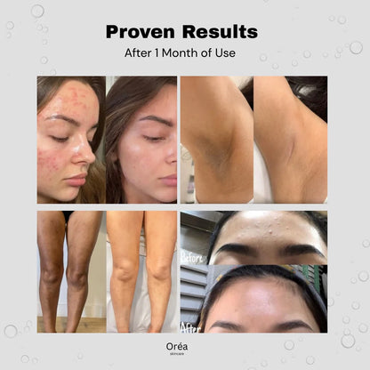 Glycolic Acid 7% Toning Solution (150ml)