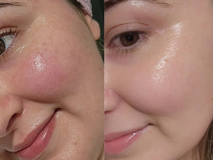 Glycolic Acid 7% Toning Solution (150ml)